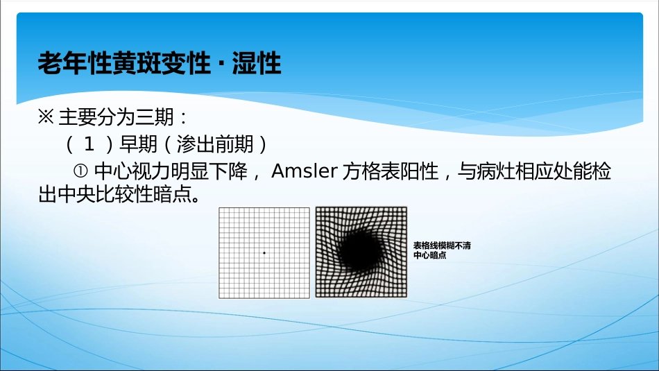 老年性黄斑变性(1)_第11页