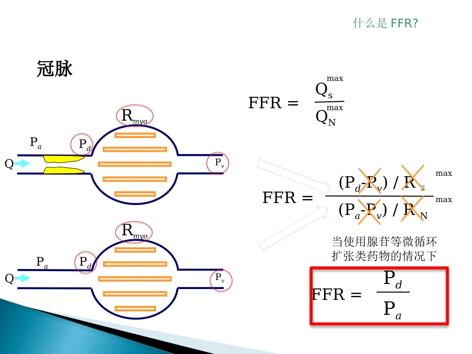 FFR 临床应用(1)_第3页