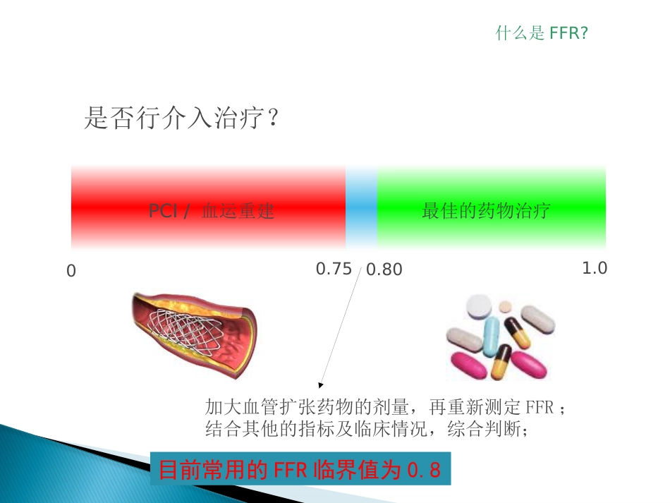 FFR 临床应用(1)_第6页