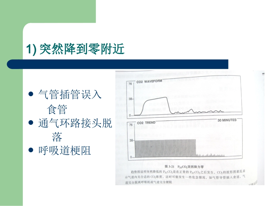 PETCO2监测的临床意义_第12页