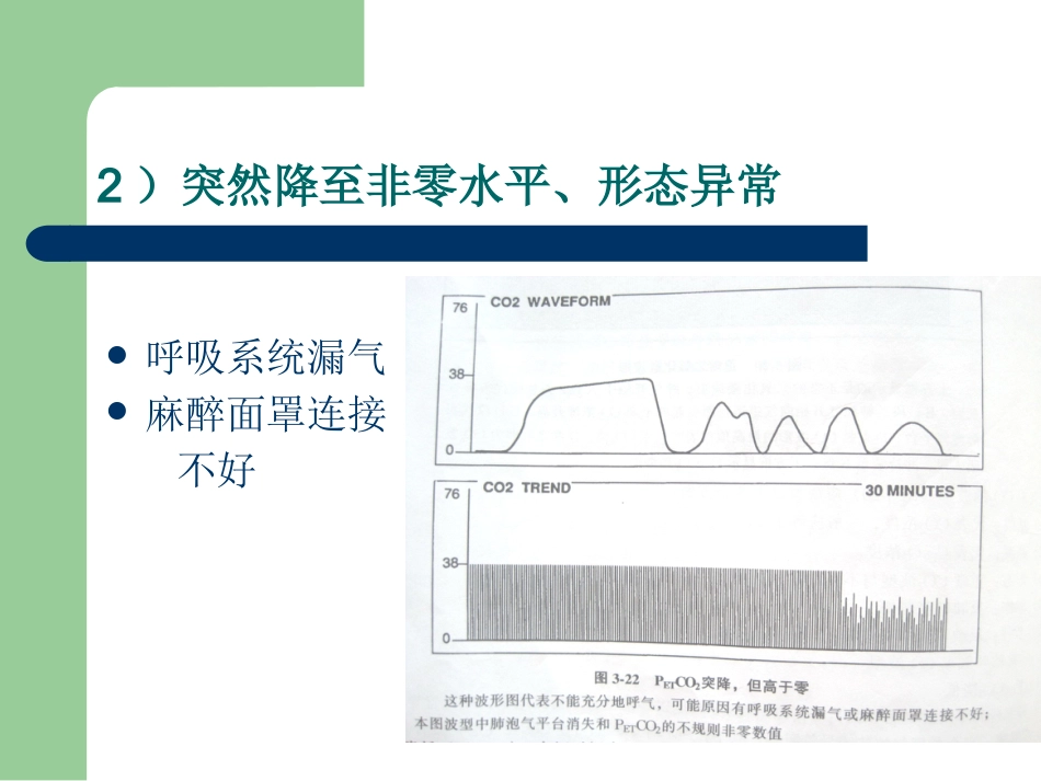 PETCO2监测的临床意义_第13页