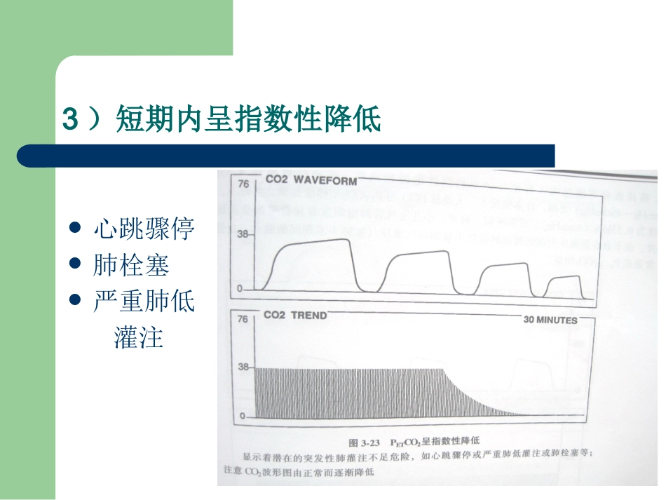 PETCO2监测的临床意义_第14页