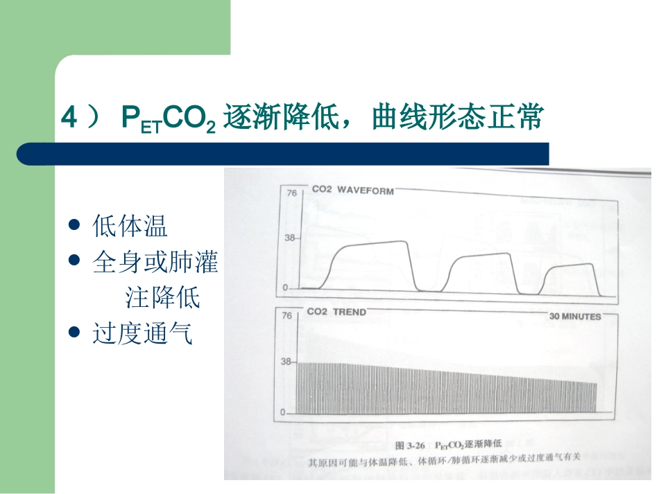 PETCO2监测的临床意义_第15页