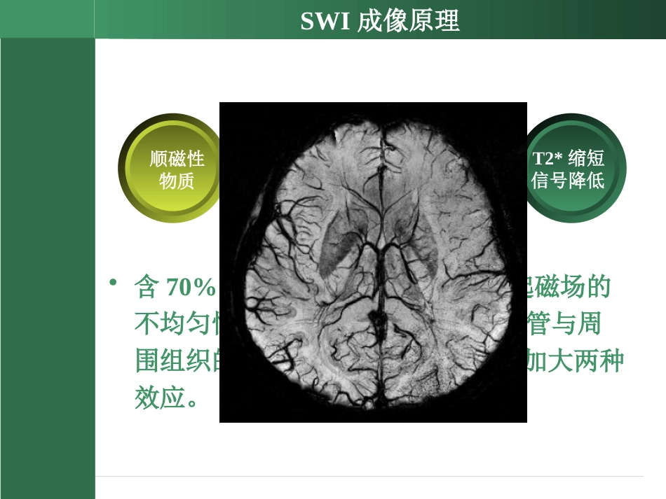 SWI的临床应用(2)_第6页