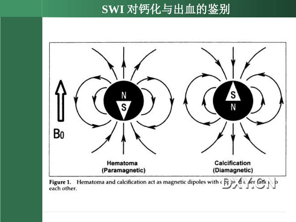 SWI的临床应用(2)_第8页