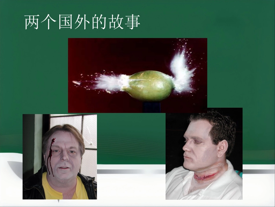 15T磁共振的临床应用(1)_第5页
