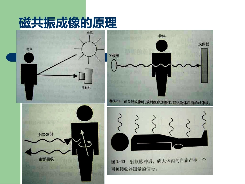 15T磁共振的临床应用_第3页