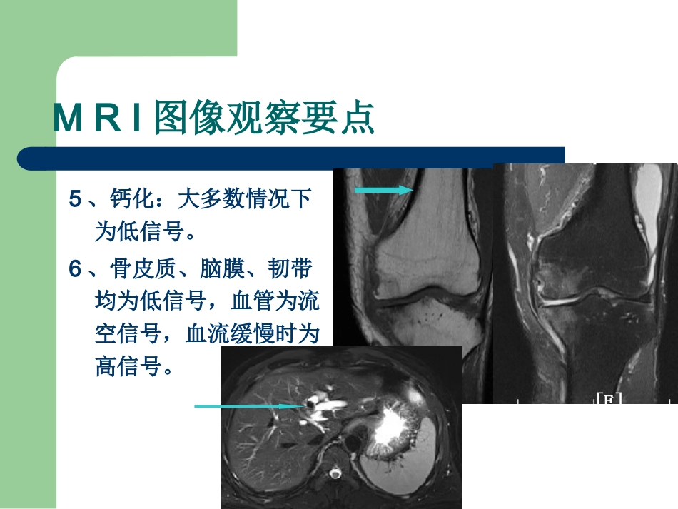 15T磁共振的临床应用_第5页