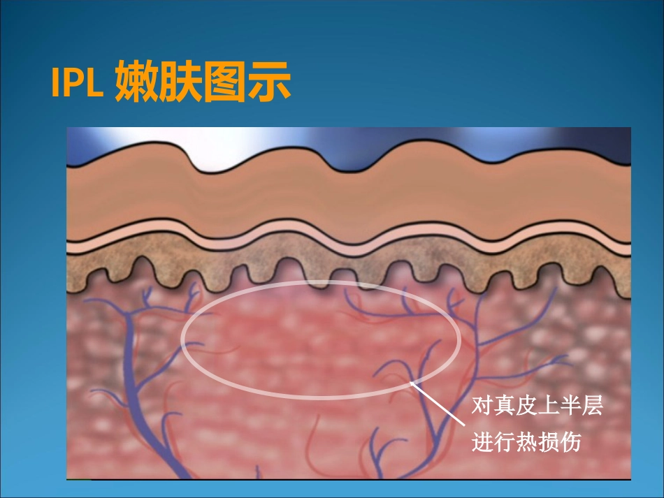 M22的临床应用_第11页