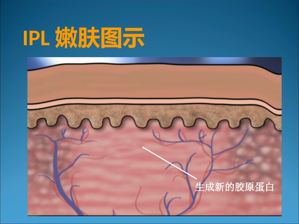 M22的临床应用_第12页