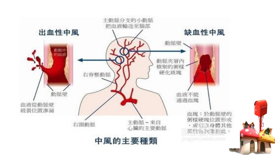 如何快速识别脑血管疾病_第8页