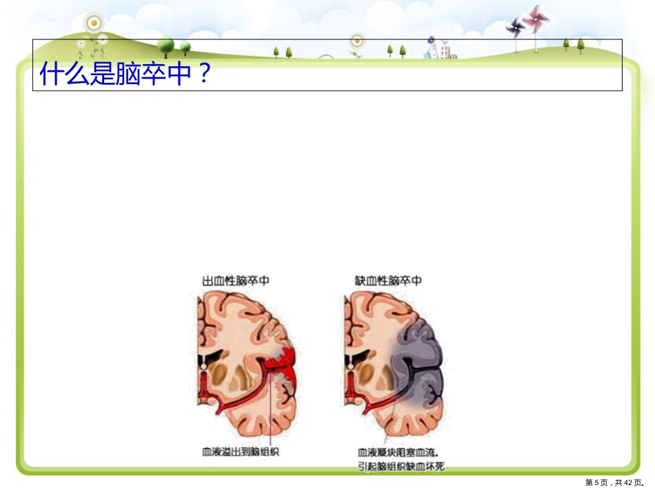脑卒中健康宣教_第5页