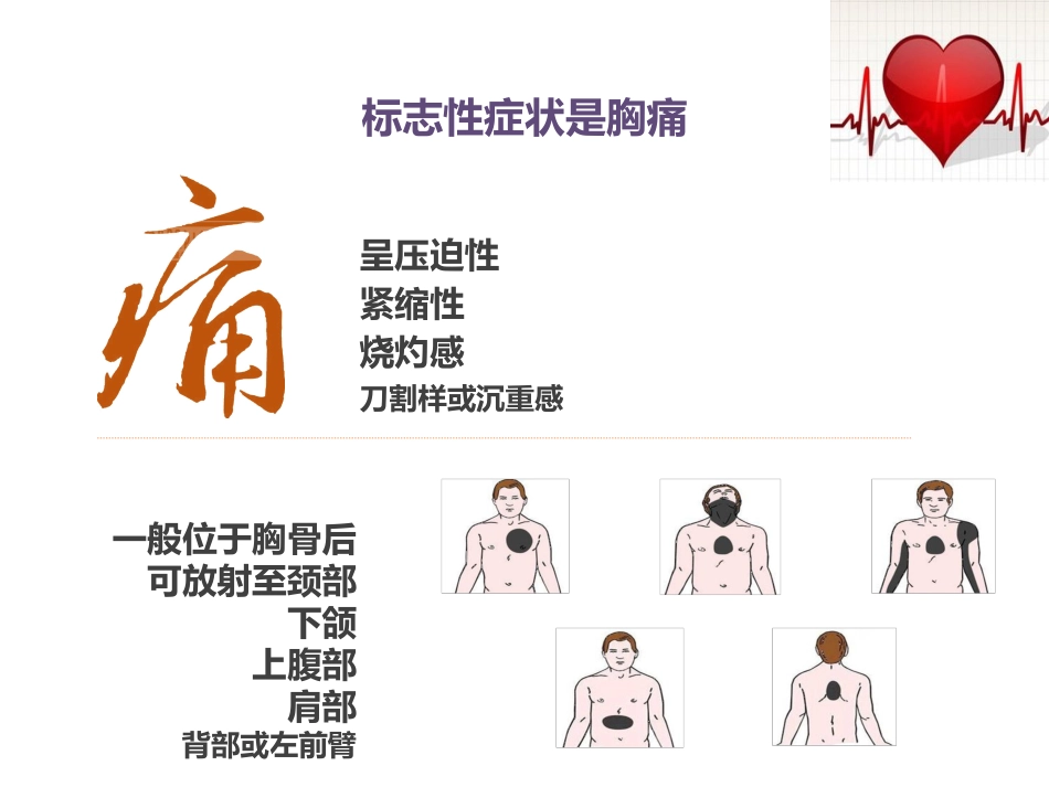 急性冠脉综合征患者健康教育_第10页