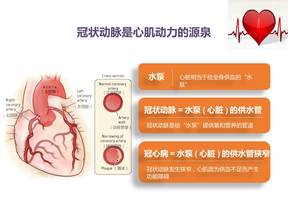 急性冠脉综合征患者健康教育_第3页