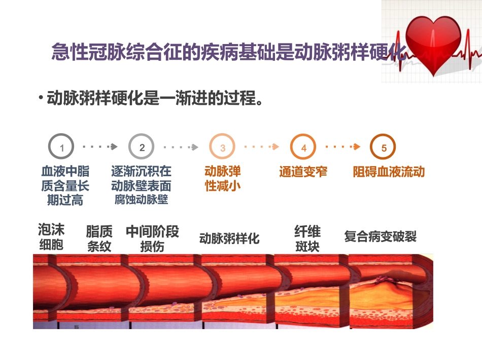 急性冠脉综合征患者健康教育_第7页