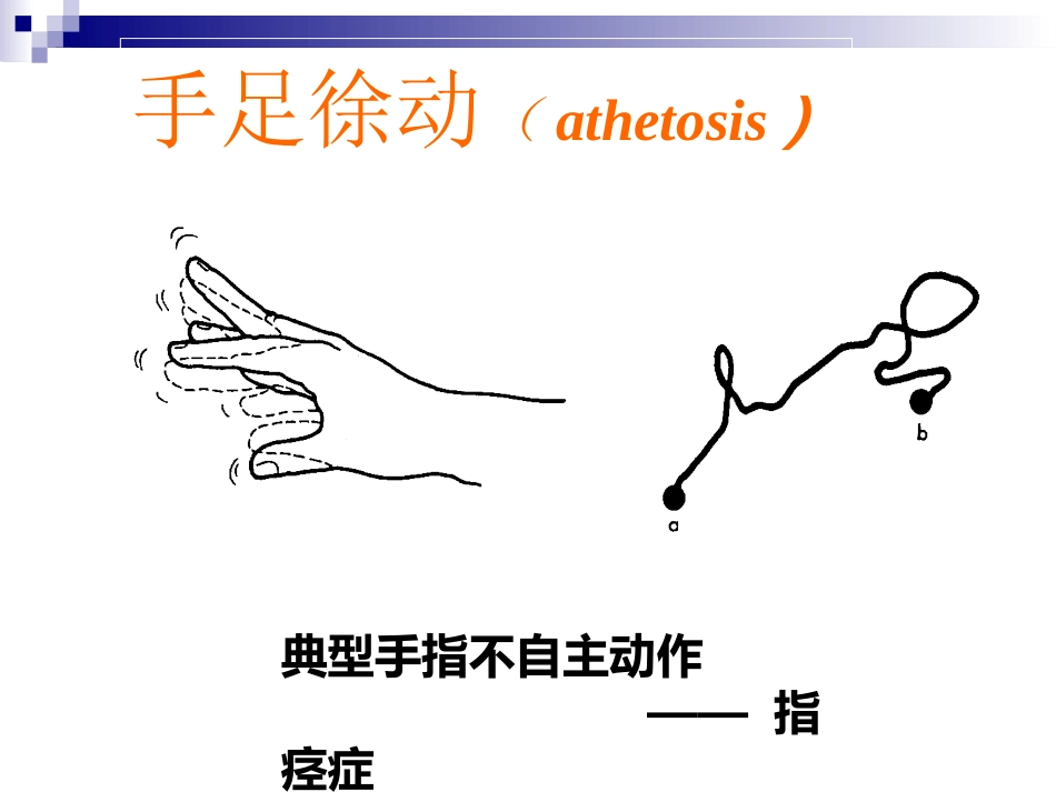 脑瘫的康复治疗_第11页