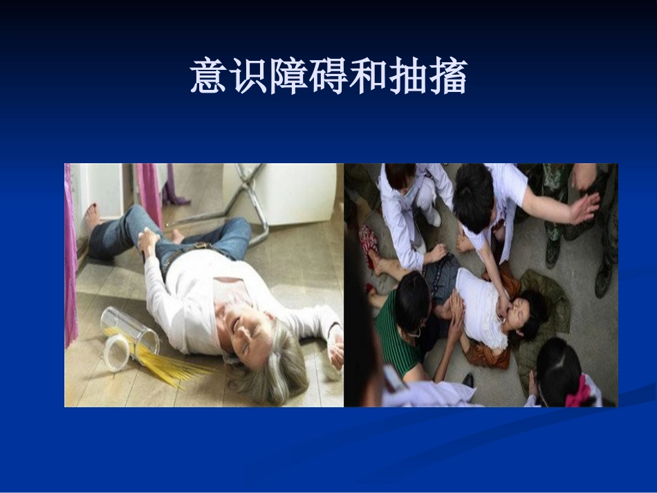 如何早期识别脑中风_第10页