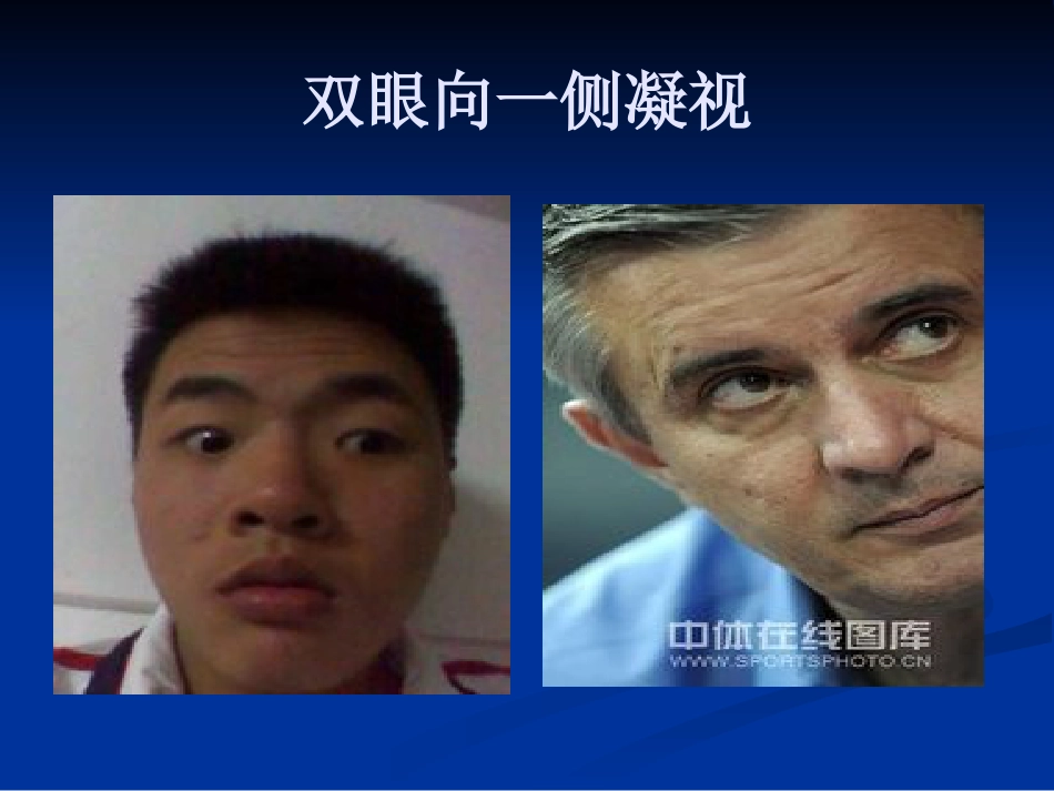 如何早期识别脑中风_第13页