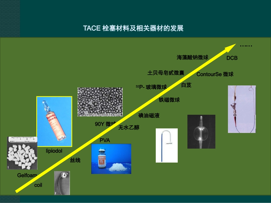 肝癌综合介入治疗进展ppt课件_第14页