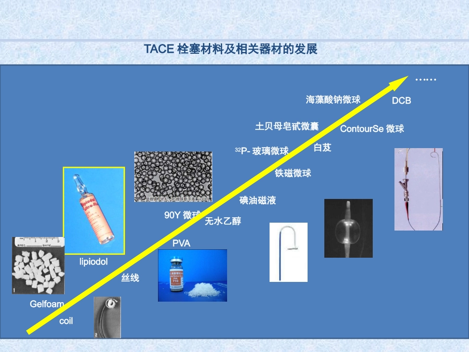 肝癌综合介入治疗进展_第14页
