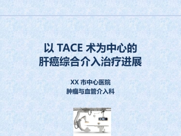 肝癌综合介入治疗进展