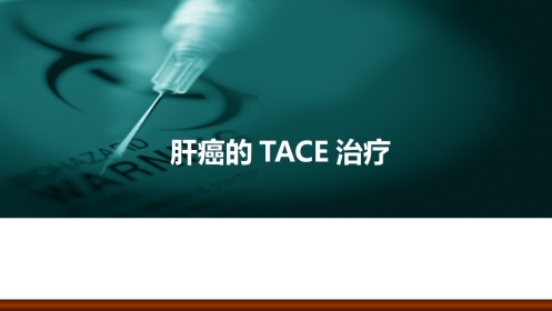 肝癌的介入治疗