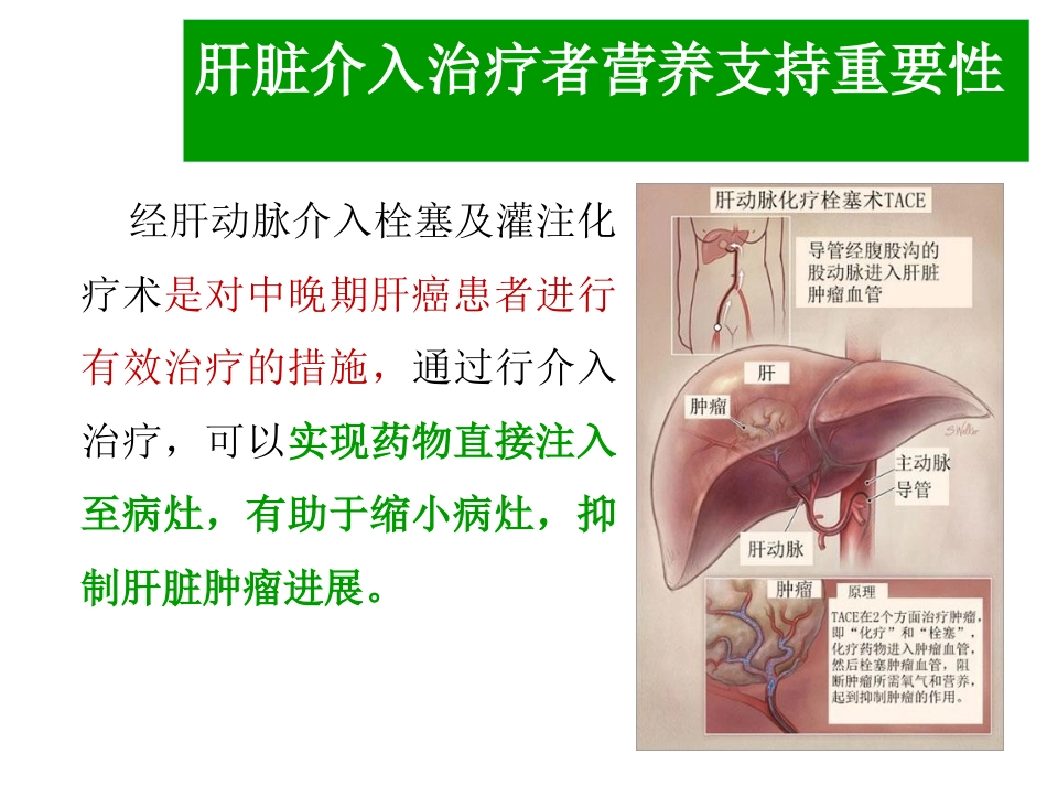 肝癌介入治疗者的营养支持_第5页
