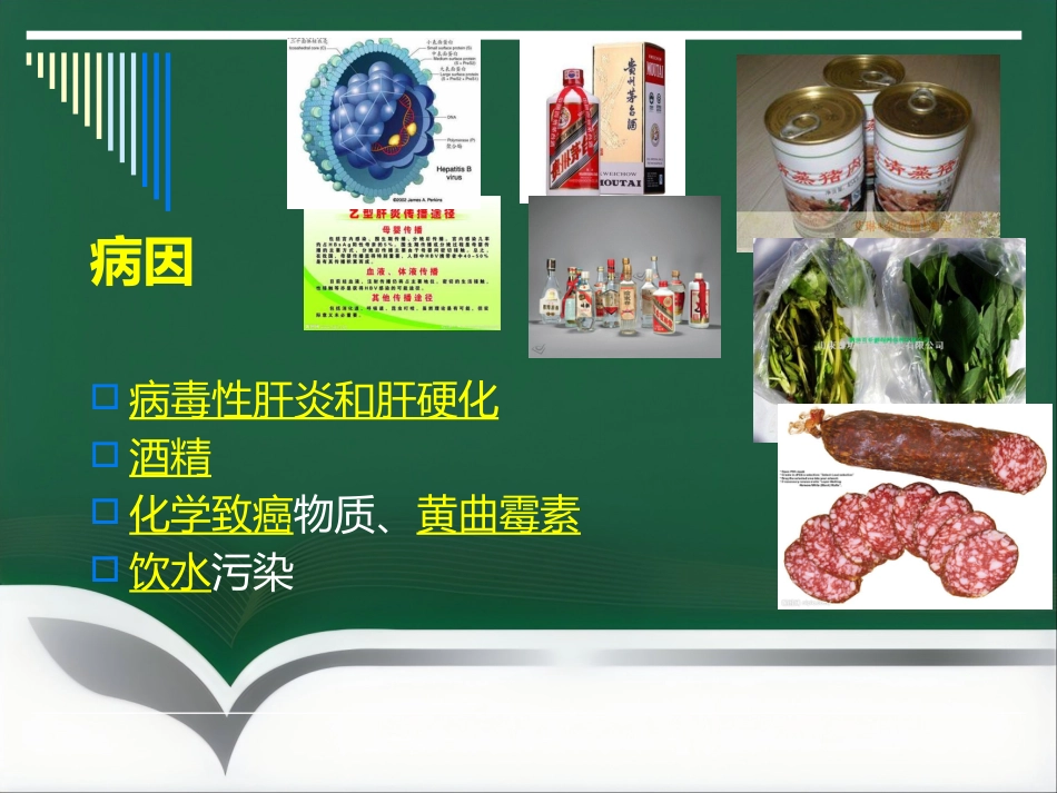 肝癌射频消融及介入治疗(1)_第5页