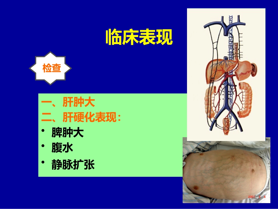 肝癌介入治疗(1)_第13页