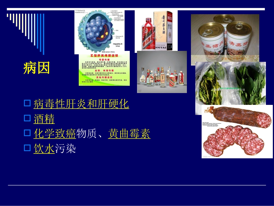 肝癌介入治疗(1)_第5页