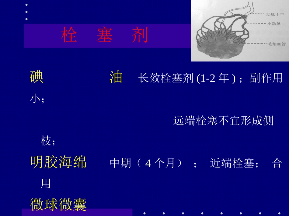 肝癌介入治疗 (2)_第15页