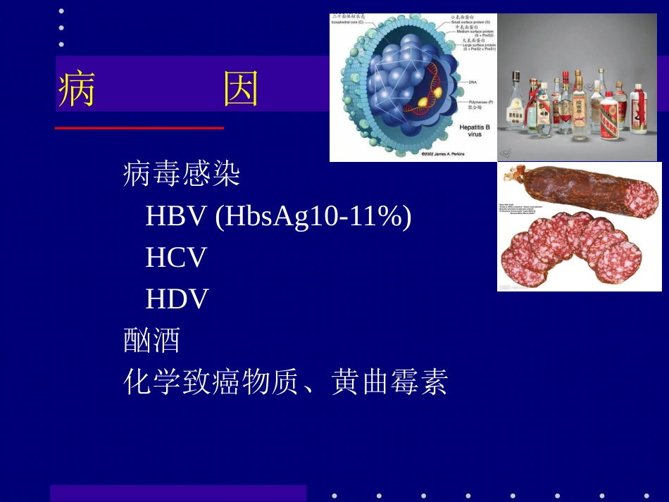 肝癌介入治疗 (2)_第4页