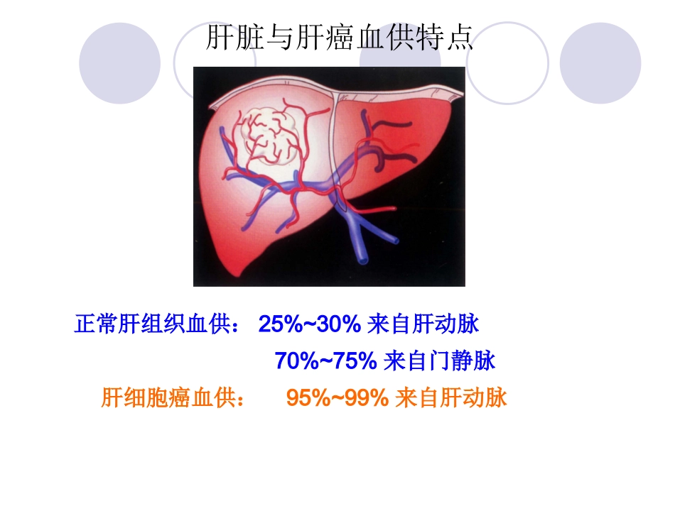 肝癌介入治疗 (3)_第4页