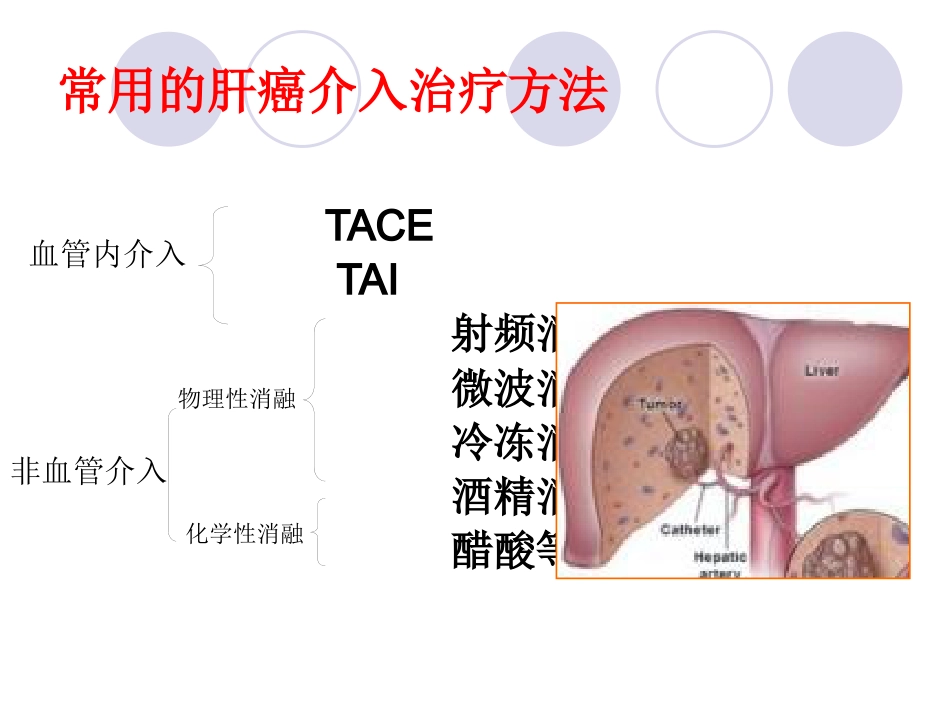 肝癌介入治疗 (3)_第5页