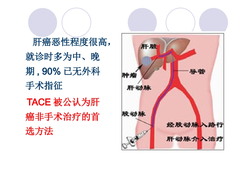 肝癌介入治疗 (3)_第6页