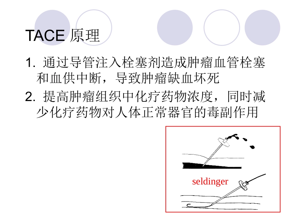 肝癌介入治疗 (3)_第7页