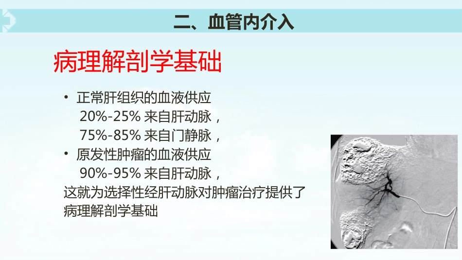 肝癌介入治疗(5)_第15页