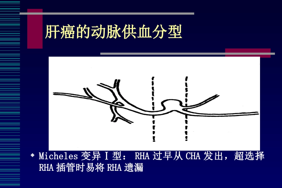 肝癌介入治疗(6)_第15页
