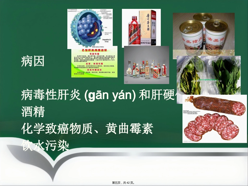 肝癌射频消融及介入治疗(共42张PPT)_第5页