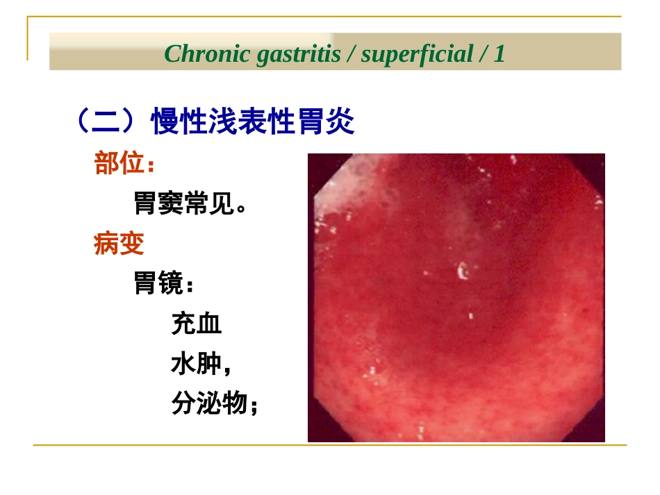 病理学—消化系统疾病(消化道,肝胆胰)_第9页