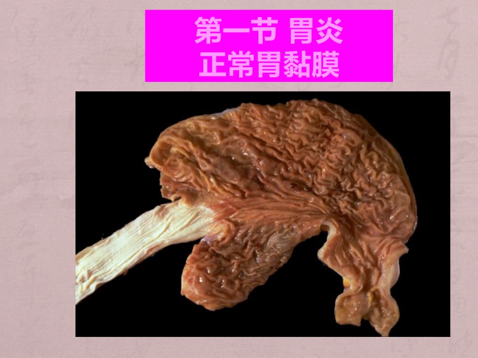 病理学消化系统疾病_第2页