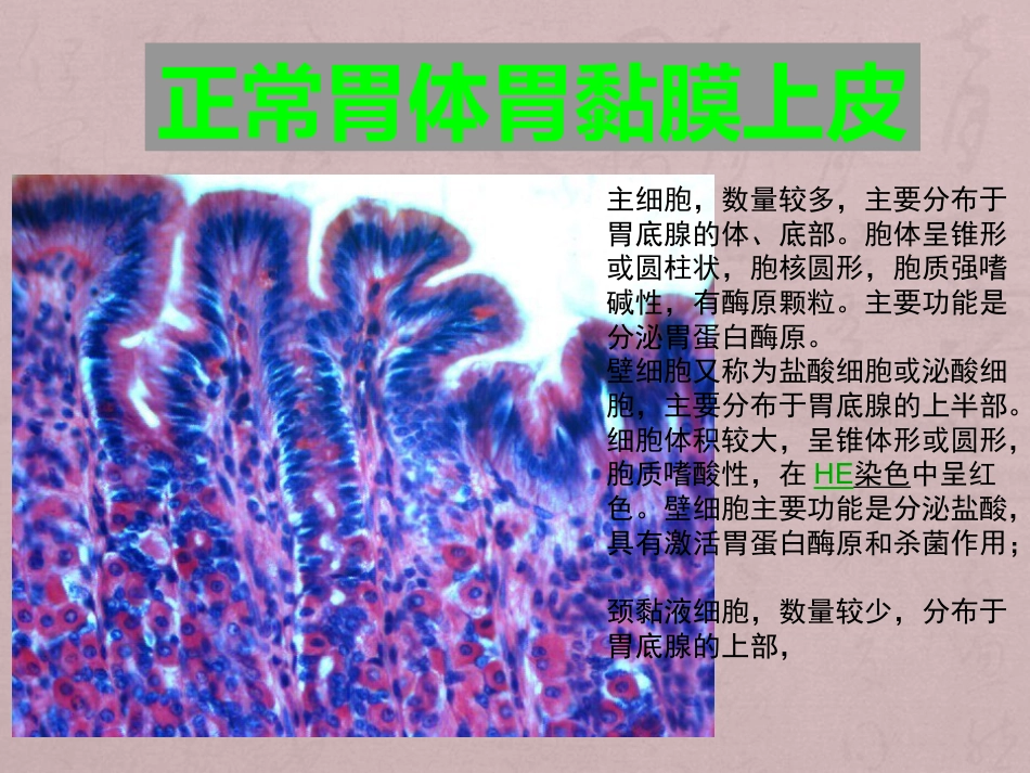 病理学消化系统疾病_第3页
