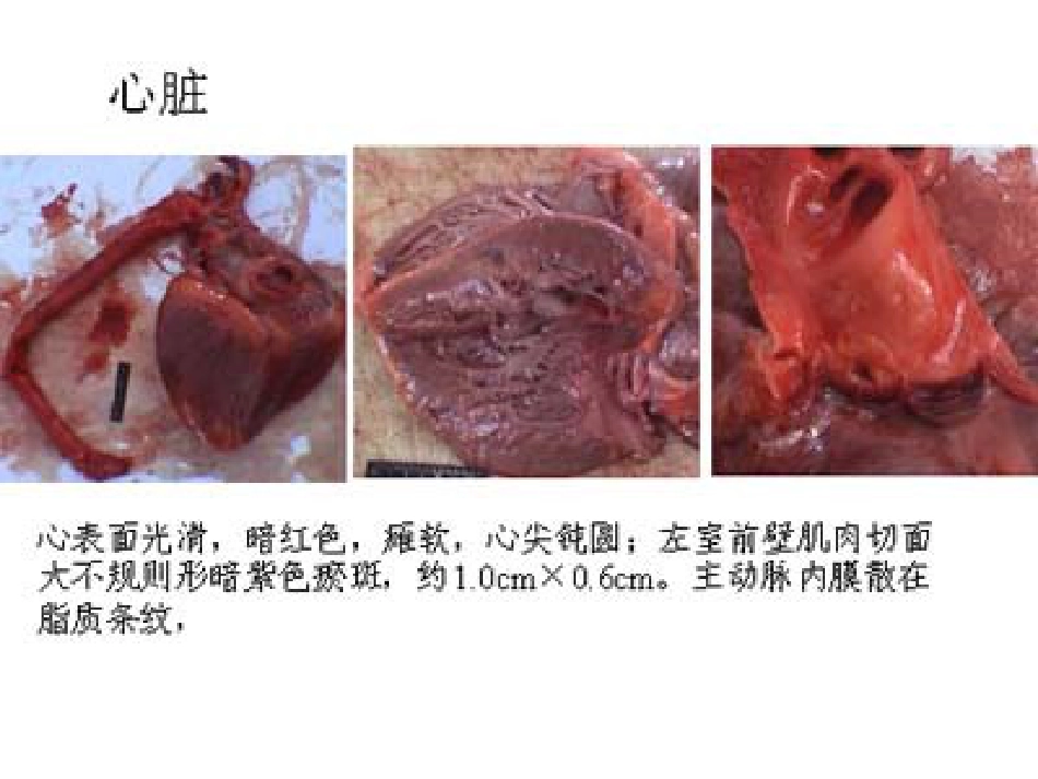 病理学心血管系统(本科)_第4页
