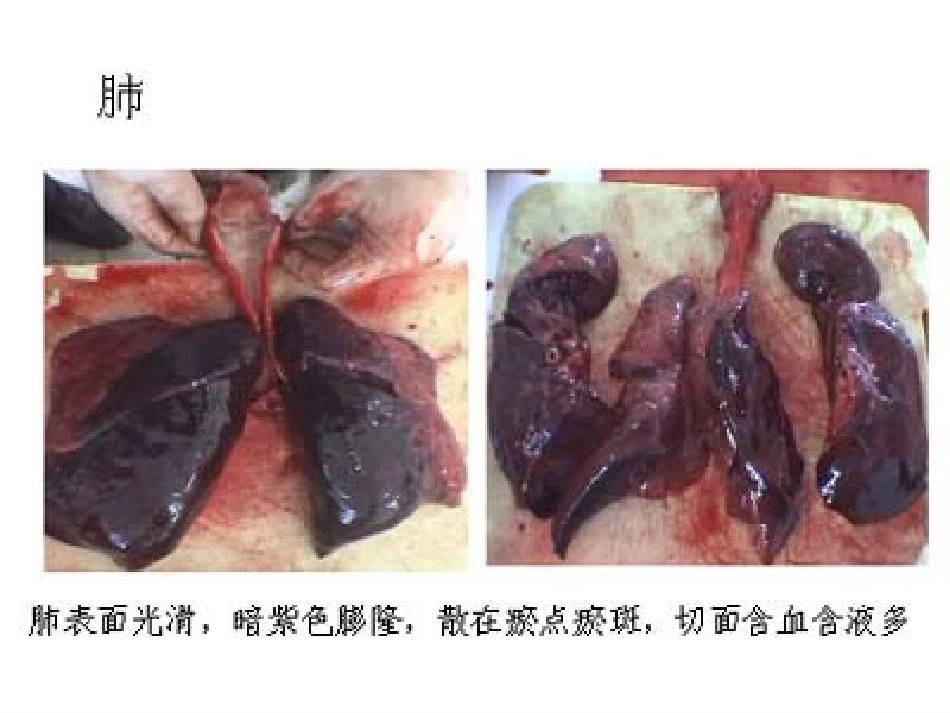 病理学心血管系统(本科)_第5页