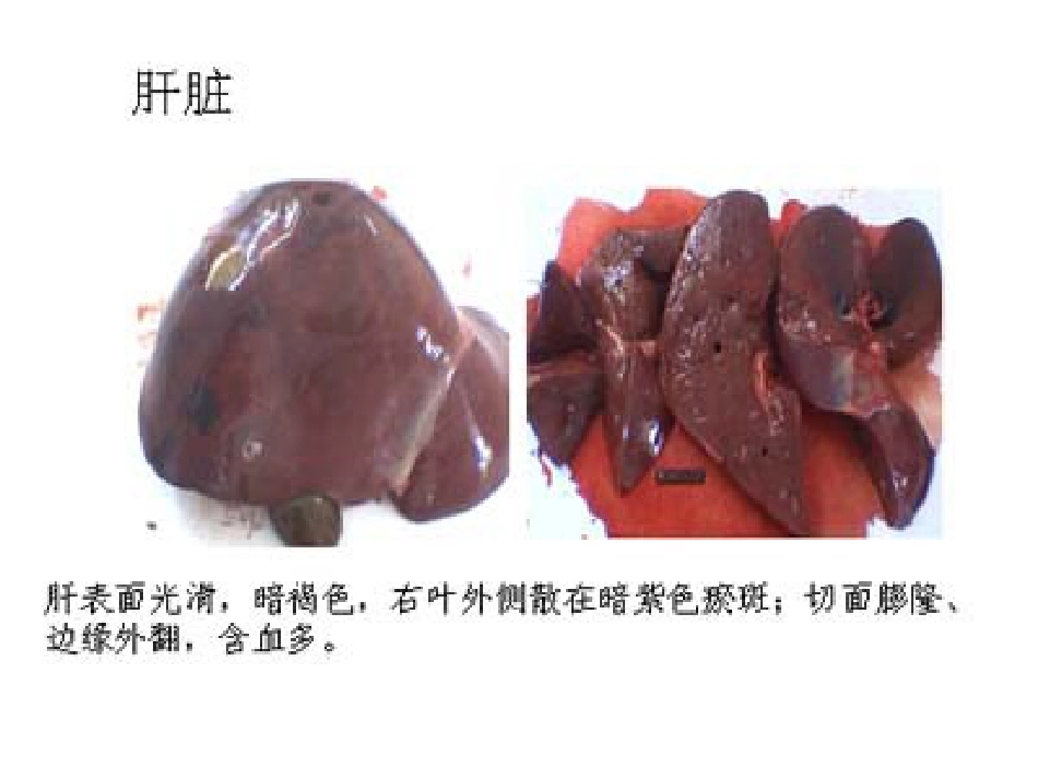 病理学心血管系统(本科)_第6页