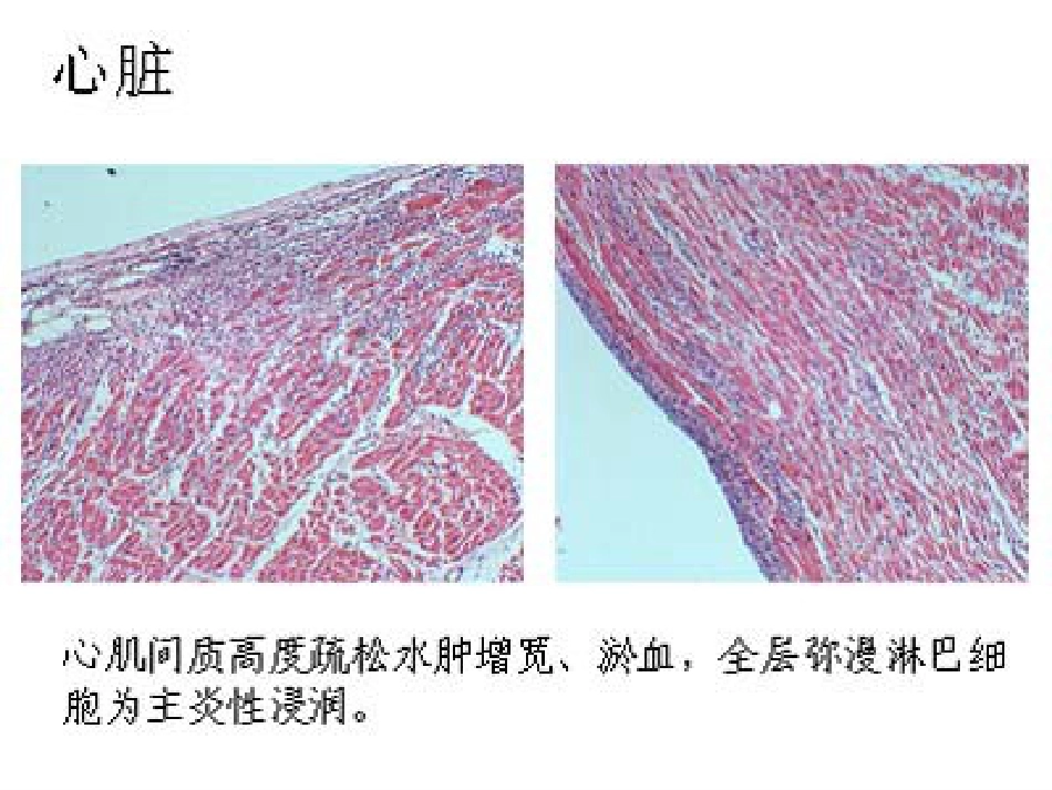 病理学心血管系统(本科)_第7页