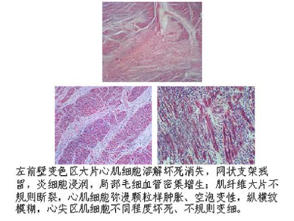 病理学心血管系统(本科)_第8页