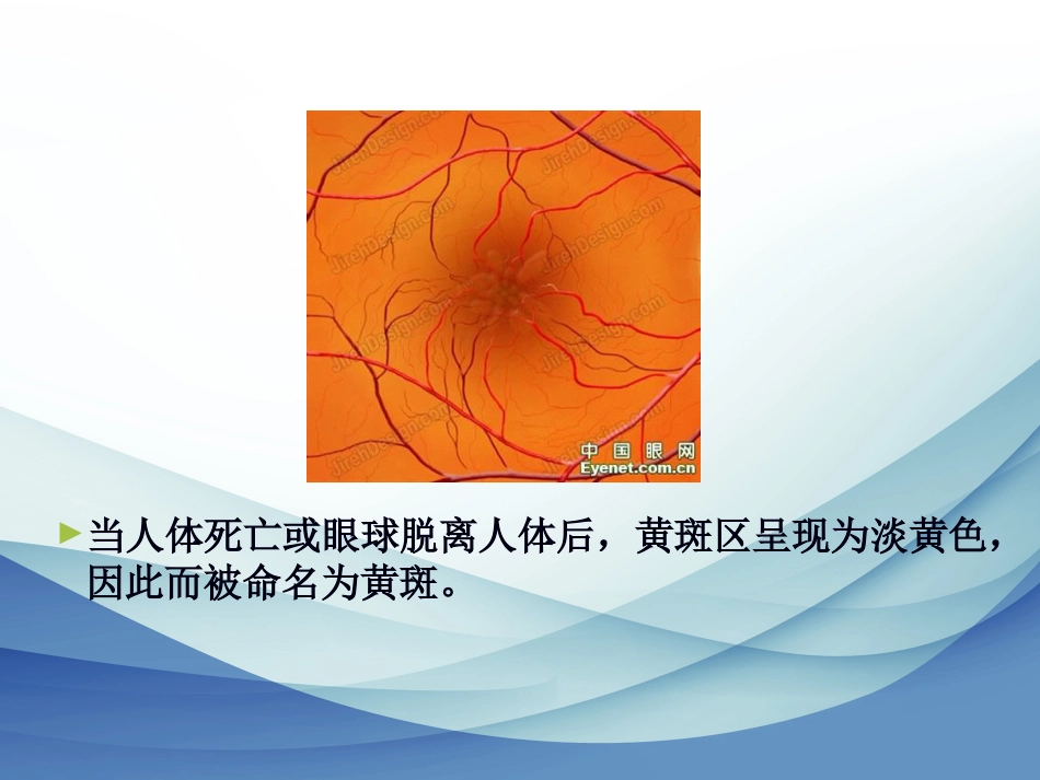 老年性黄斑变性标准版_第5页