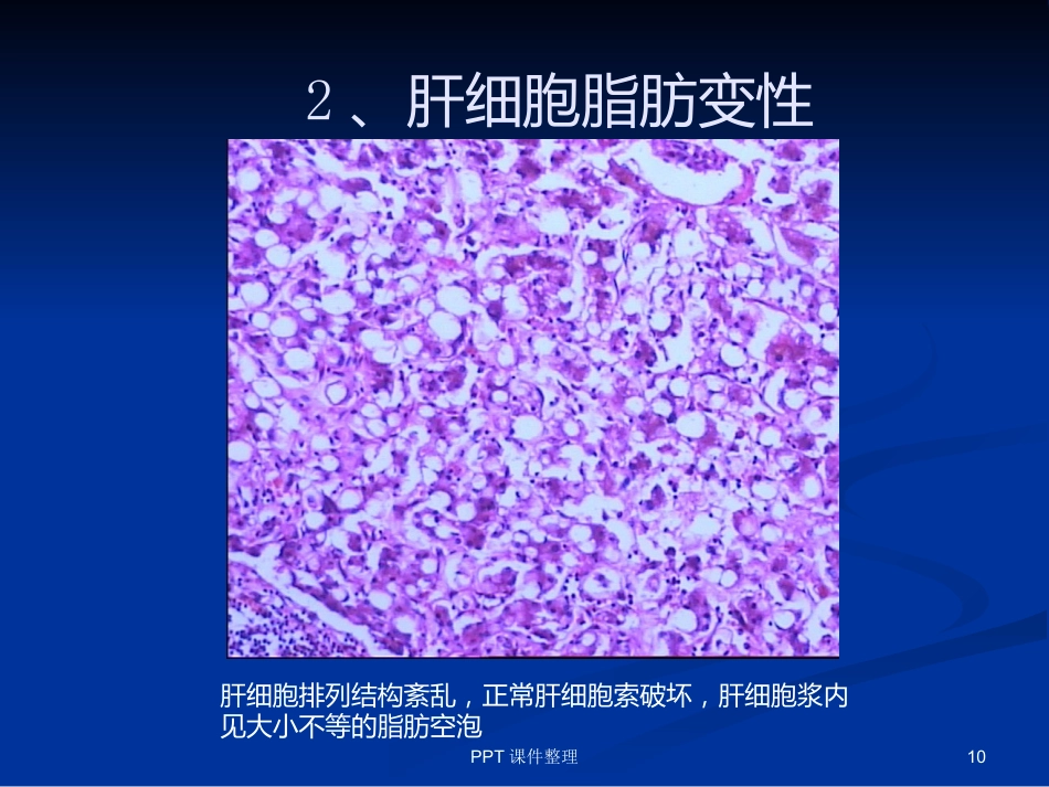 病理学图谱 实验一、细胞组织的适应、损伤与损伤修复_第10页
