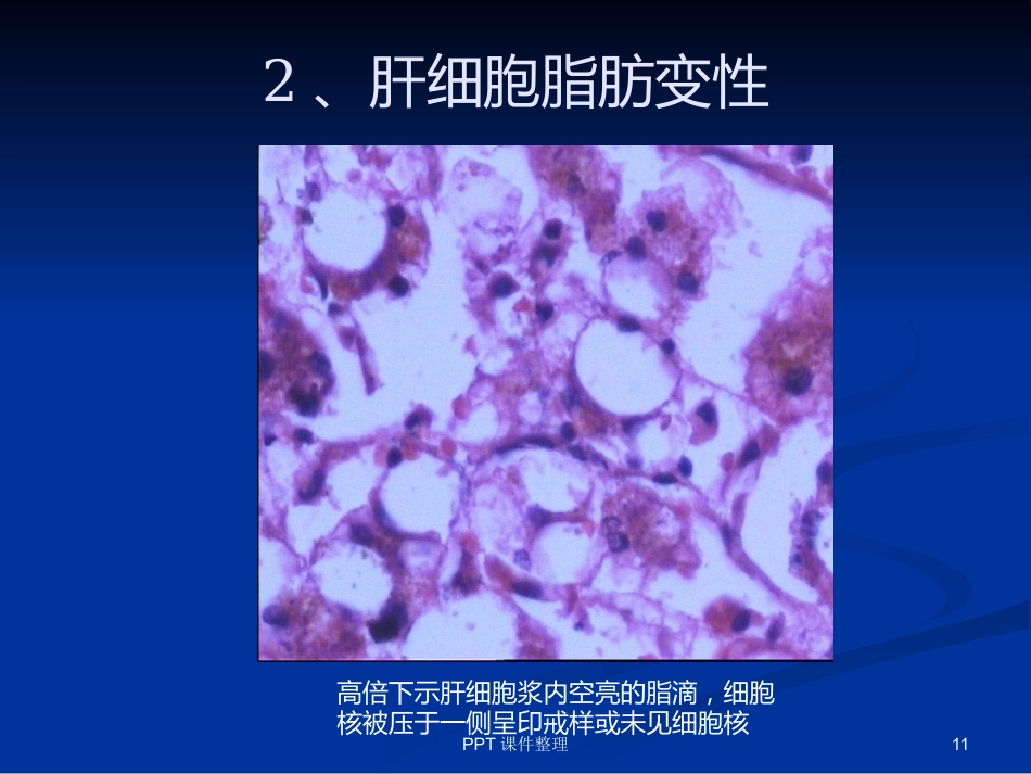 病理学图谱 实验一、细胞组织的适应、损伤与损伤修复_第11页